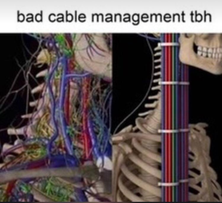 cable